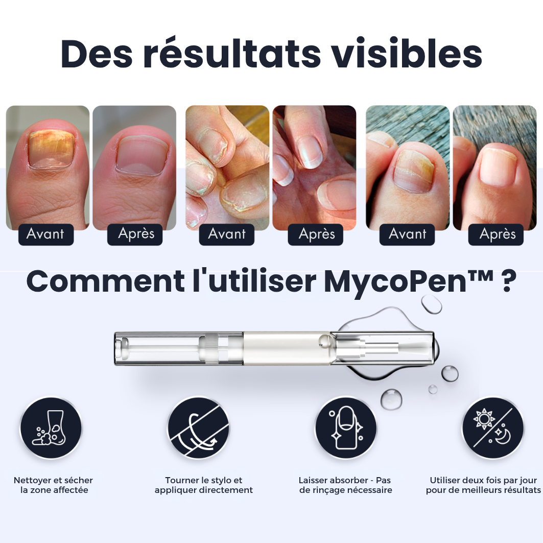 MycoPen™ - Stylo antifongique