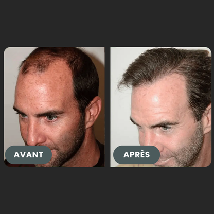 Folixir - Votre allié contre la perte de cheveux