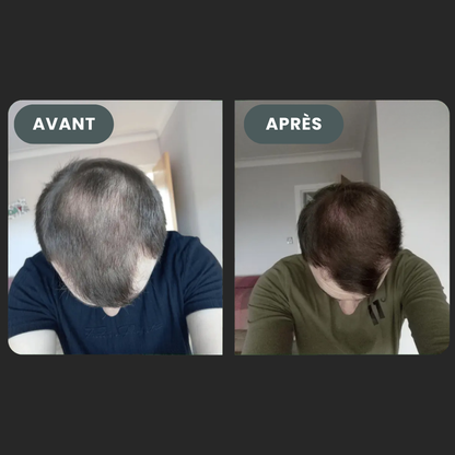 Folixir - Votre allié contre la perte de cheveux